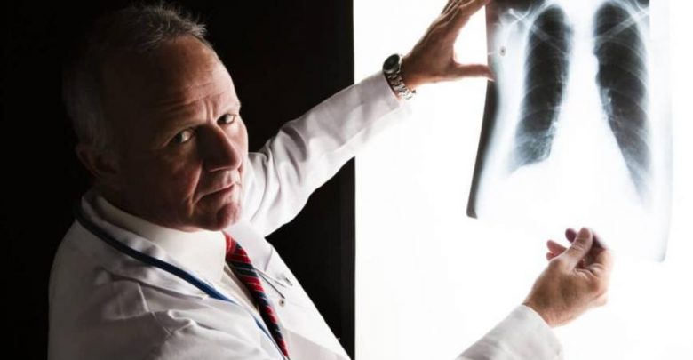 "جوجل" تتفوق على أطباء الأشعة في الكشف عن سرطان الرئة